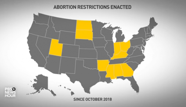 Abortion Restrictions